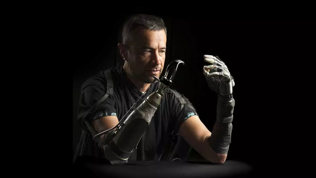 Bridging the Gap: AI Enhances Bionic Hand Functionality for Amputees