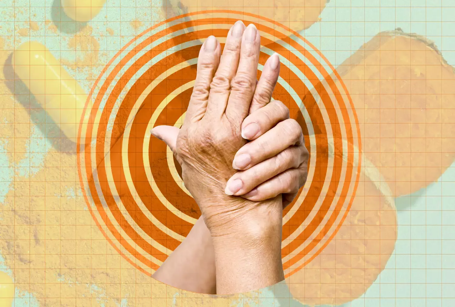 Dietary Strategies to Mitigate Arthritis Flare-Ups