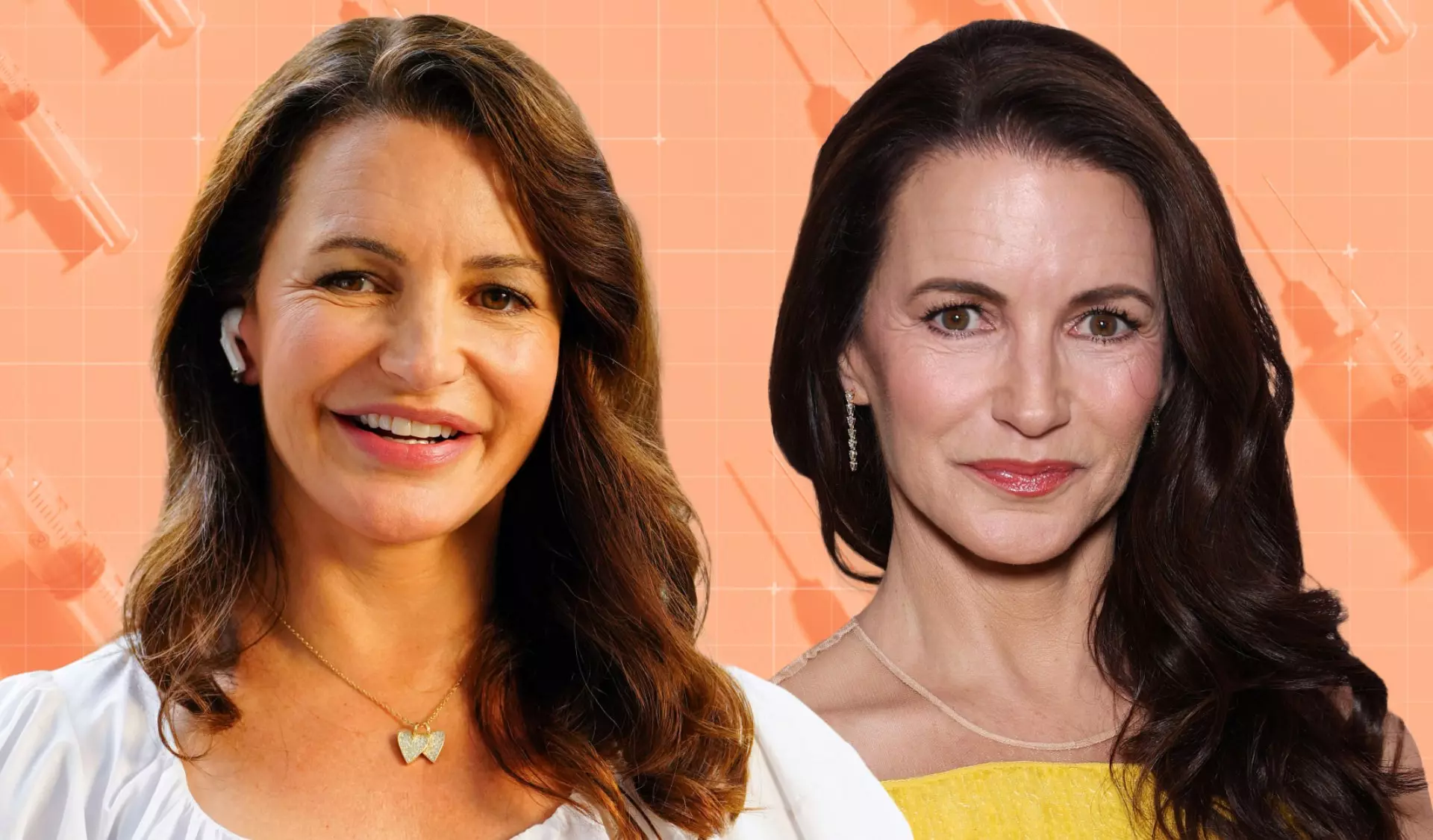 The Facial Filler Backlash: A Deep Dive into Celebrity Experiences and Expert Opinions