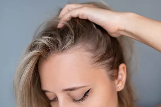 Veradermics: Pioneer in Pattern Hair Loss Treatment with Promising Oral Minoxidil
