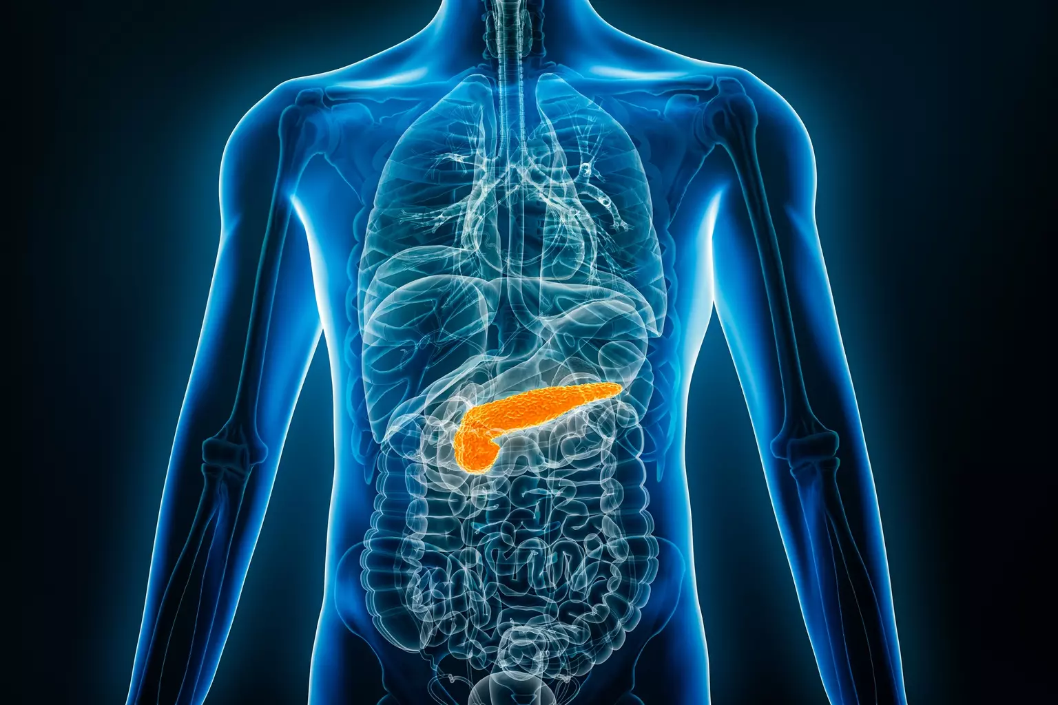 Tango Therapeutics' Vopimetostat Shows Early Promise in Pancreatic Cancer Treatment